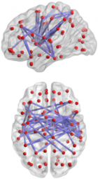 Simulación de redes neuronales (en construcción)